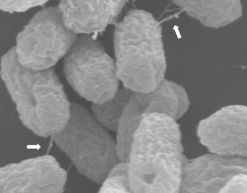 E. coli ST131 superbugs captured transferring their antibiotic resistance plasmid through a syringe-like structure (indicated by arrows).