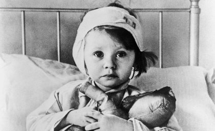 Head and brain injuries are infants' most frequent injuries from assault Head and brain injuries are infants' most frequent injuries from assault