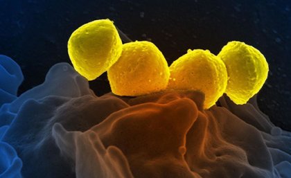 Scanning electron micrograph of Group A Streptococcus bacteria on primary human neutrophil. Credit: NIAID