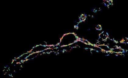 Protein essential for neuronal communication viewed via super-resolution microscopy Protein essential for neuronal communication viewed via super-resolution microscopy
