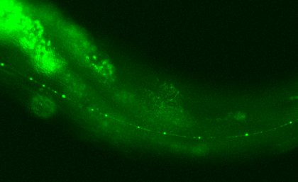 Caenorhabditis elegans (C. elegans) Caenorhabditis elegans (C. elegans)