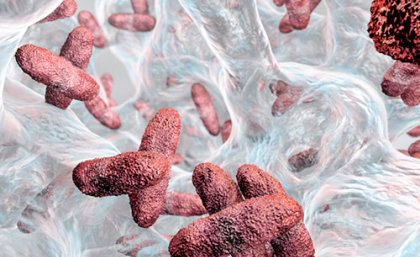 Superbug Klebsiella Superbug Klebsiella