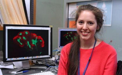 UQ PhD student Elanor Wainwright is one of only 14 people accepted into the Cold Spring Harbor Laboratory’s Mouse Development, Stem Cells and Cancer course in New York from 5-25 June.