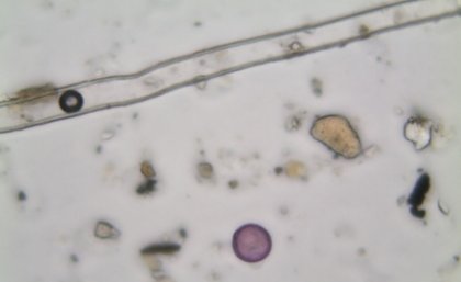 Image of a grass pollen, a major trigger of hay fever says UQ's Dr Janet Davies. Image of a grass pollen, a major trigger of hay fever says UQ's Dr Janet Davies.