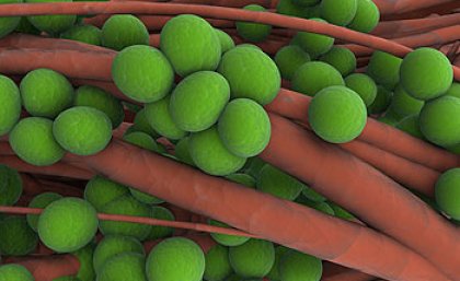 Cells from Staphylococcus Aureus (Golden Staph) Cells from Staphylococcus Aureus (Golden Staph)