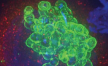 Group A Streptococcus (green) shown to be growing inside of a cell (red, caputured by a fluorescence microscope).