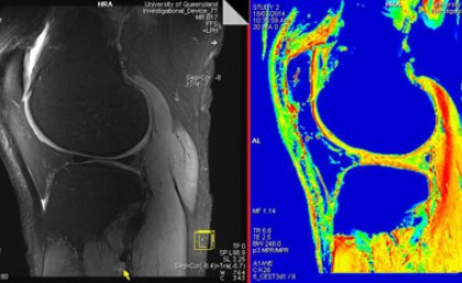 Caption: UQ’s Centre for Advanced Imaging captured these images on its 7 Tesla (T) whole-body Magnetic Resonance Imaging scanner.