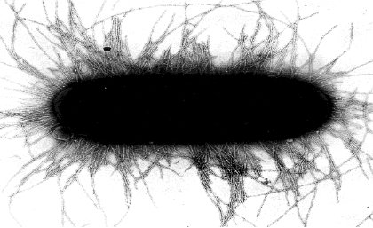 The potentially devastating E. coli ST131 superbug The potentially devastating E. coli ST131 superbug