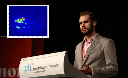 Medical undergraduate Charles Baker has developed a mathematical model to improve liver imaging methods. Inset: An image of a liver with five lesions.