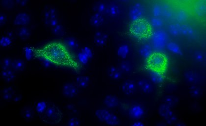 Sieci perinuronalne (jasnozielone) otaczają poszczególne neurony (niebieski).  Etykietowanie fluorescencyjne ujawnia, jak szczegółowe są te struktury.  (Phoebe Mayne, UQ)