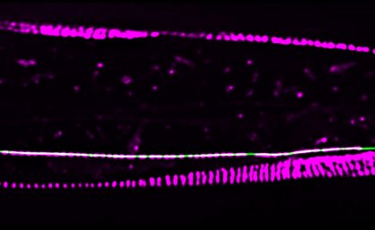 Attachment sites (magenta) in the surrounding skin of roundworm nerve cells act as a glue, helping the cells remain intact during periods of strain. Attachment sites (magenta) in the surrounding skin of roundworm nerve cells act as a glue, helping the cells remain intact during periods of strain.