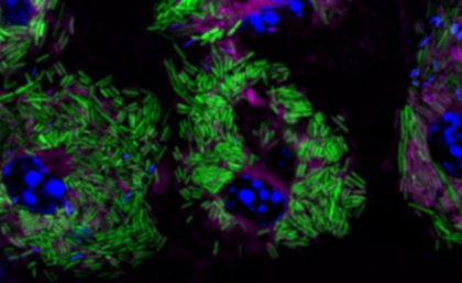 A drug-like inhibitor that stops Listeria from making virulence proteins helps immune cells control and kill the bacteria. Image: Dr Carmen Mathmann. Image of listeria in blue and green colours