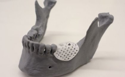 A model jaw covered by a small latticed 3d-printed cover 