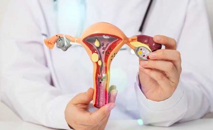 doctor holding 3D model of uterus