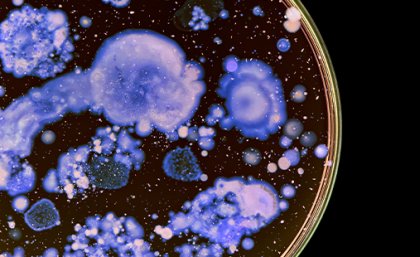 Bacteria growing in a petri dish. Image: Adobe Macro photo of colourful bacteria in a petri dish.