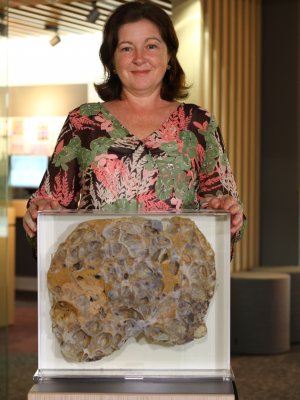  Fiona Murray, a kidney and liver recipient, donated her polycystic liver to UQ