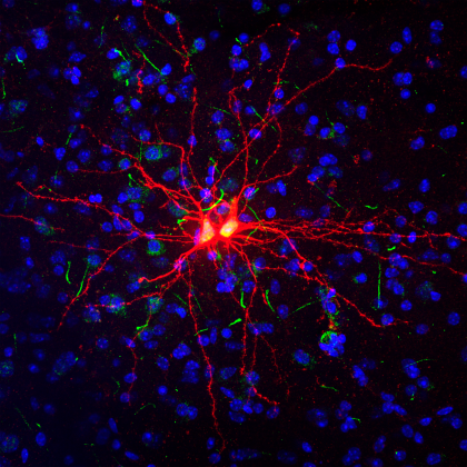 Newly generated twin neurons in the adult amygdala, an area of the brain playing a central role in emotional processing. Newly generated twin neurons in the adult amygdala, an area of the brain playing a central role in emotional processing.