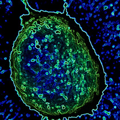 Working at the nanoscale, using materials with dimensions thousands of times smaller than the width of a human hair, allows researchers to accurately target treatments with minimal harm to surrounding cells Working at the nanoscale, using materials with dimensions thousands of times smaller than the width of a human hair, allows researchers to accurately target treatments with minimal harm to surrounding cells