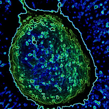 Working at the nanoscale, using materials with dimensions thousands of times smaller than the width of a human hair, allows researchers to accurately target treatments with minimal harm to surrounding cells