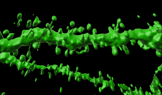 Dendritic spines under magnification. Image, UQ.