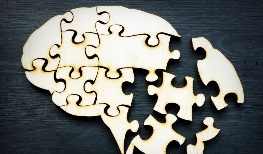 A puzzle of the human brain with pieces incomplete.