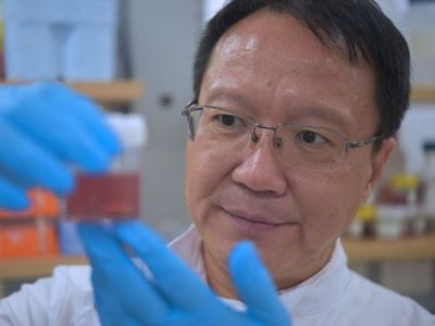 Researcher in a lab examining a container of sample nanoparticles used in breast cancer research. 