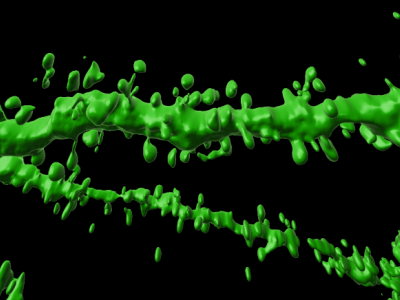 Dendritic spines under magnification. Image, UQ.