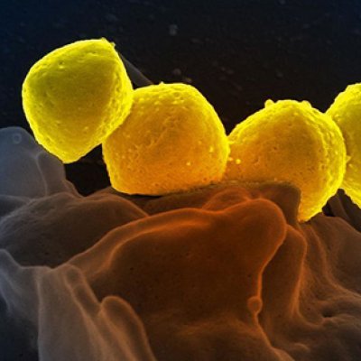 Scanning electron micrograph of Group A Streptococcus bacteria on primary human neutrophil. Credit: NIAID