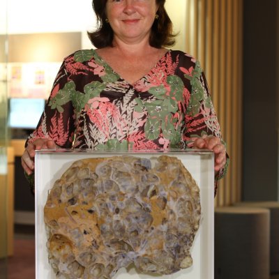  Fiona Murray, a kidney and liver recipient, donated her polycystic liver to UQ