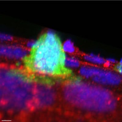 A potential cancer cell extruding from an epithelium. Courtesy of Selwin Wu, Yap Lab, UQ's Institute for Molecular Bioscience.