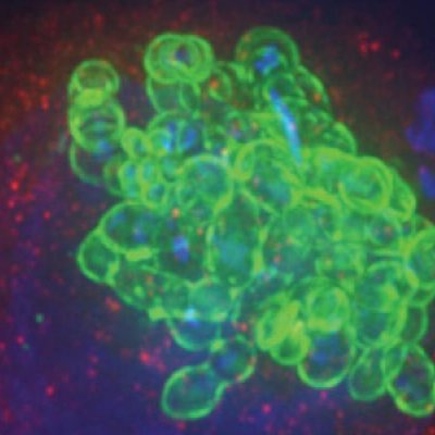 Group A Streptococcus (green) shown to be growing inside of a cell (red, caputured by a fluorescence microscope).