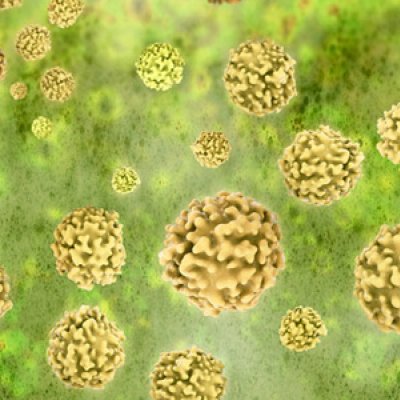 Gonorrhoea is a bacterial infection with similar characteristics to chlamydia.