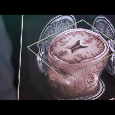 Screen grab of the online Introduction to Biomedical Imaging BIOIMG101x course.