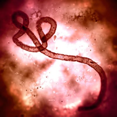 UQ has a range of experts able to speak on the Ebola virus.