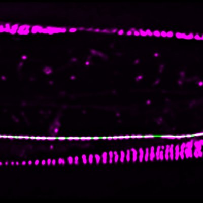 Attachment sites (magenta) in the surrounding skin of roundworm nerve cells act as a glue, helping the cells remain intact during periods of strain. 