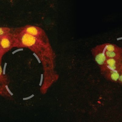 Normal sea squirt muscle cells form a ring shape (left), but after “boss gene” intervention (right), the cells cluster quite differently. Images: Nathan Palpant.