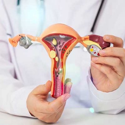 doctor holding 3D model of uterus
