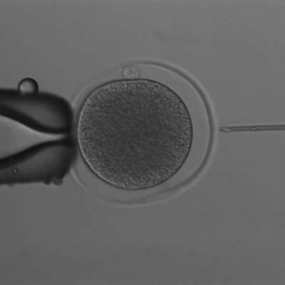 A black and white photo of a syringe being injected into an egg from a uterus. 