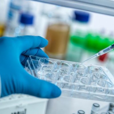 A gloved hand holds a tray of vials as a pipette hovers in a laboratory setting.