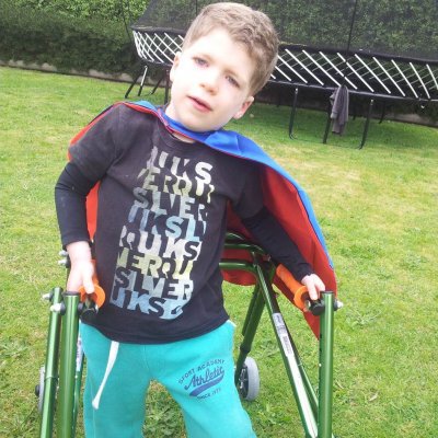 Ashton “Little Superman” Hancock, has hypoplasia of the corpus callosum, resulting in epilepsy and hearing impairment