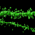 Dendritic spines under magnification. Image, UQ.