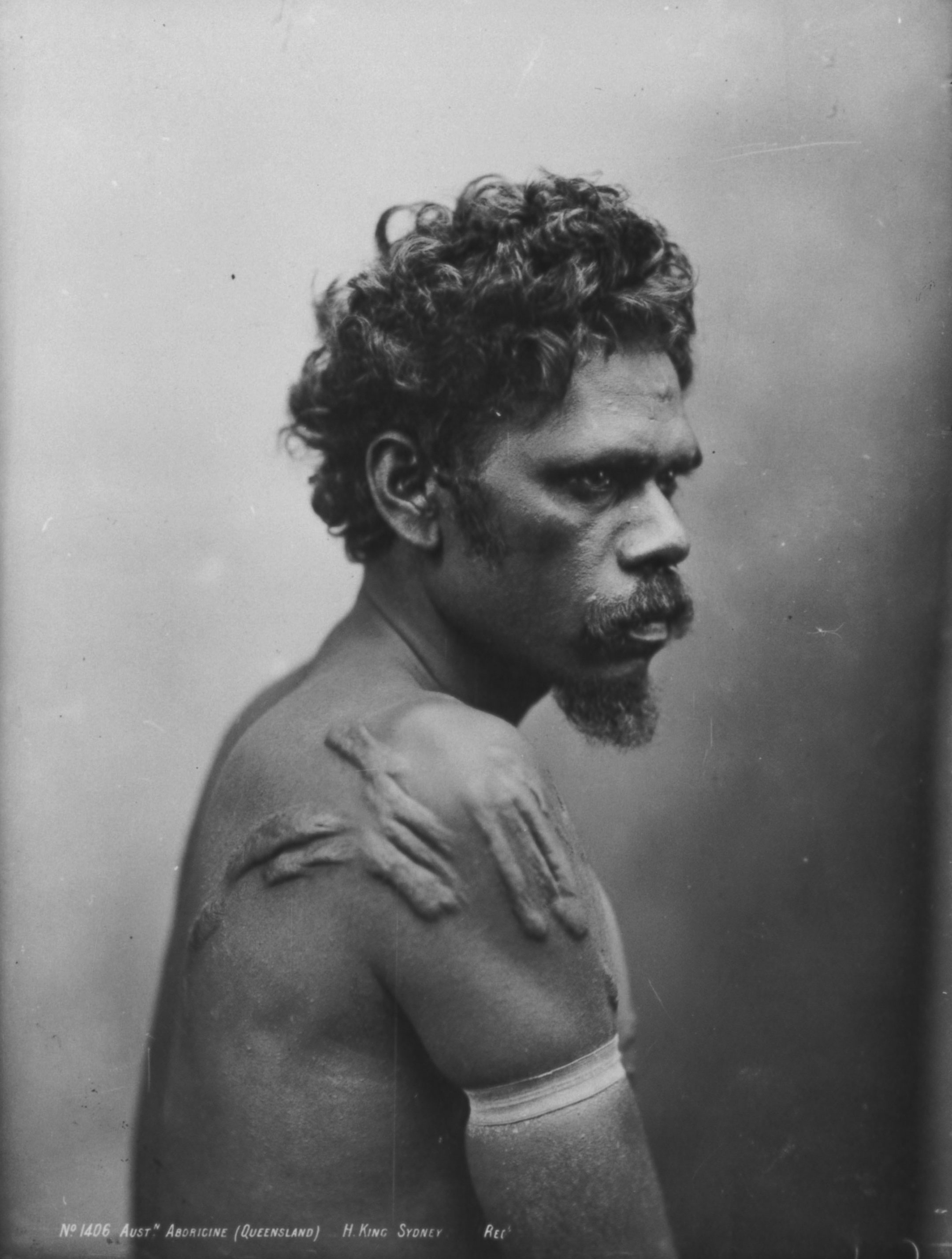 Yungkwa, Sydney, June 1893 (Photo by Henry King, UQ Anthropology Museum Collection)