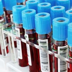 Medical vials of blood