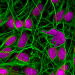 Pink cells