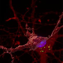 A celluar process gone astray allows the toxic protein tau to leak into healthy brain cells.