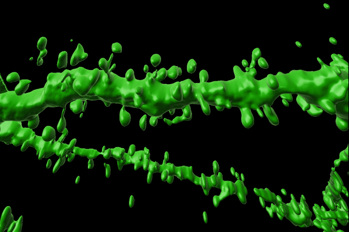 Dentritic spines under magnification